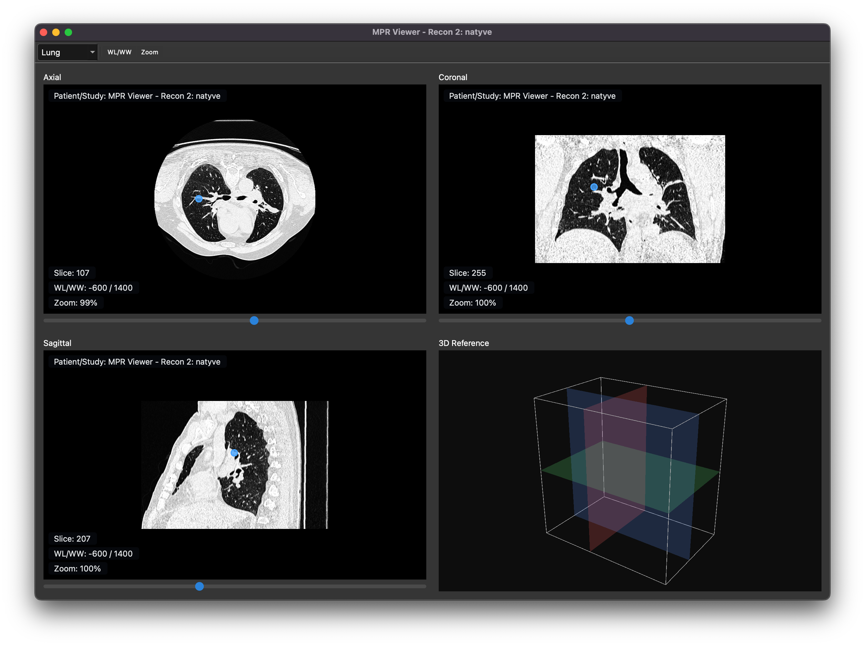 Cross Axial Dicom Viewer